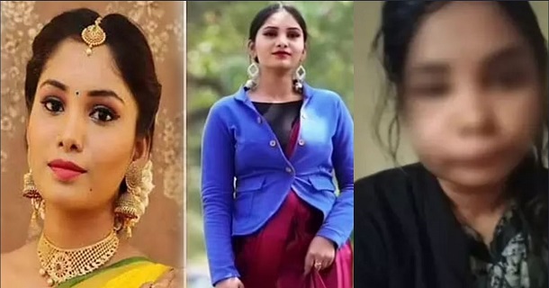 Kannada actress swathi sathish face got unrecognisable after root canal surgery