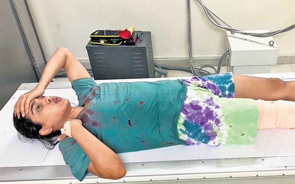 Samyuktha hegde accident during shooting video getting viral on social media