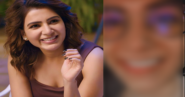 samantha face got changed after treatment fans got shocked