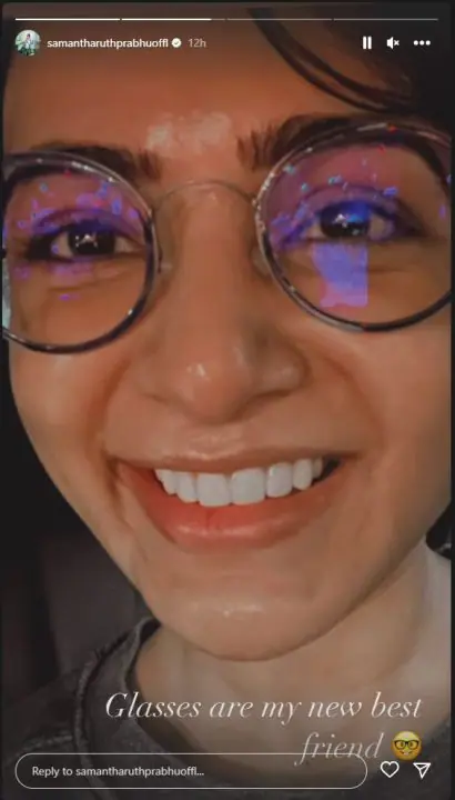 samantha face got changed after treatment fans got shocked